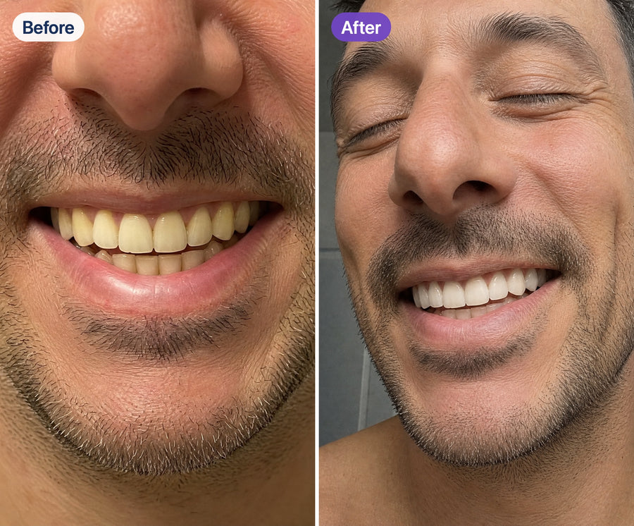 Before and after using Riverwell Purple Whitening Toothpaste