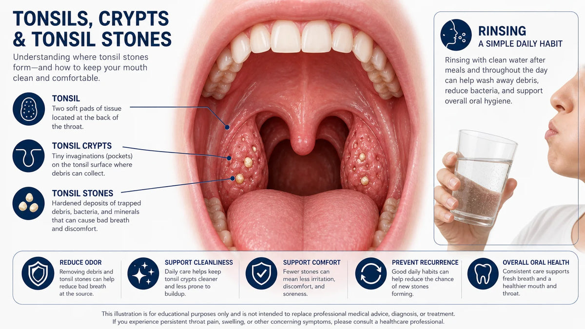 Medical illustration of tonsils, crypts and small tonsil stones with a rinsing glass