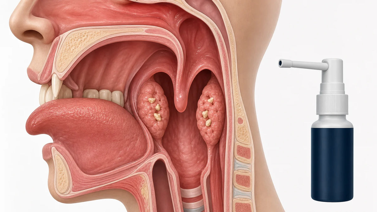 3D throat cross-section showing tonsil crypts with small tonsil stones