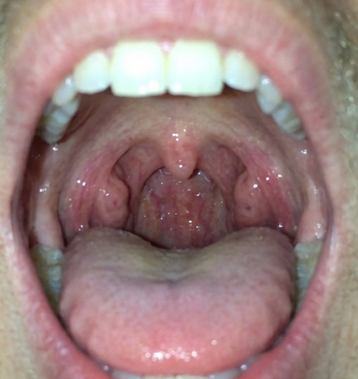 After 4 week
