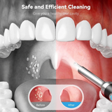 Tonsil Stone Removal Complete Kit & Camera UHD