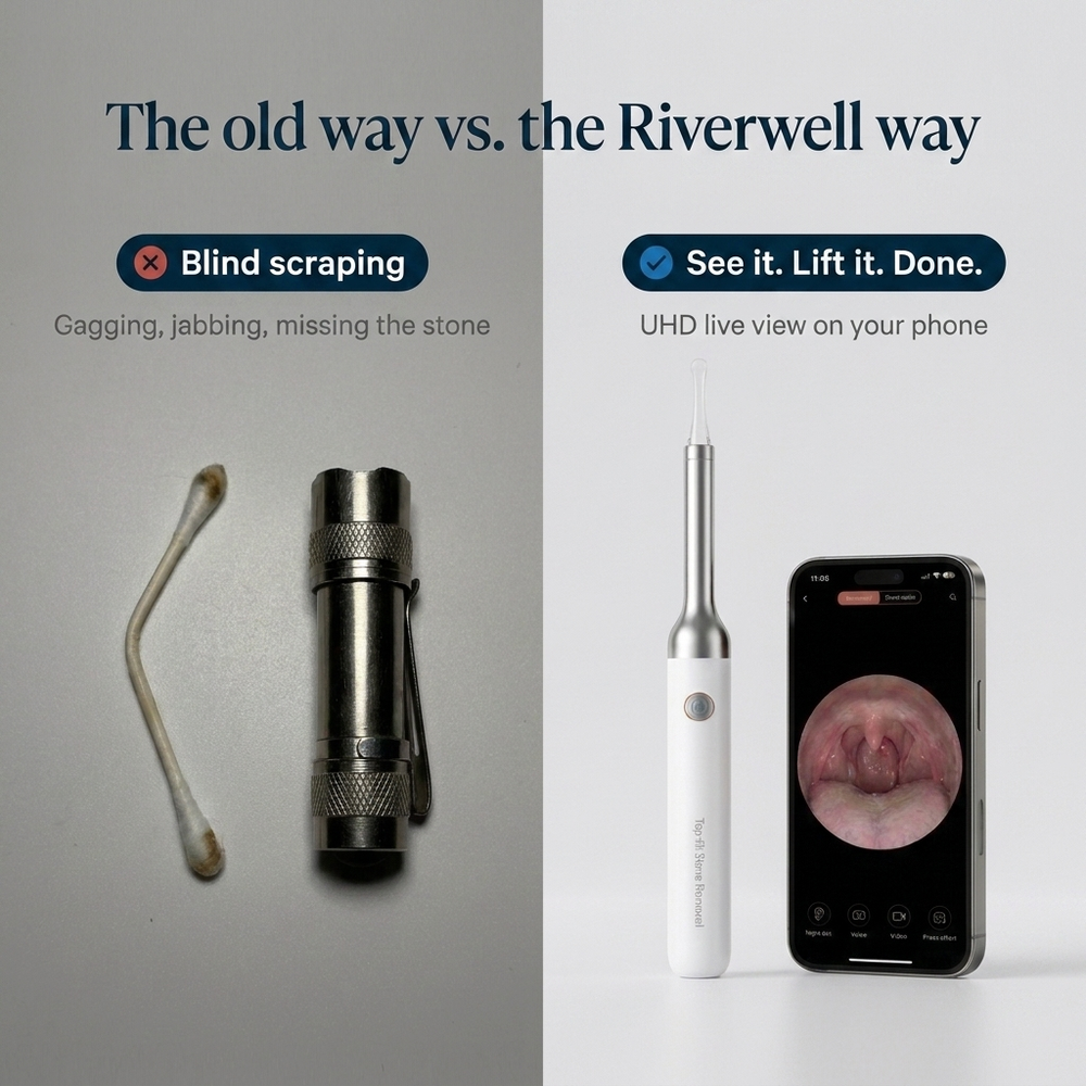 Tonsil Stone Removal Complete Kit & Camera UHD