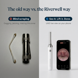 Tonsil Stone Removal Complete Kit & Camera UHD