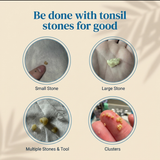 Tonsil Stone Cleaner - Deep Clean & Protective Barrier